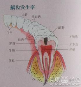 龋坏有没有禁忌呢