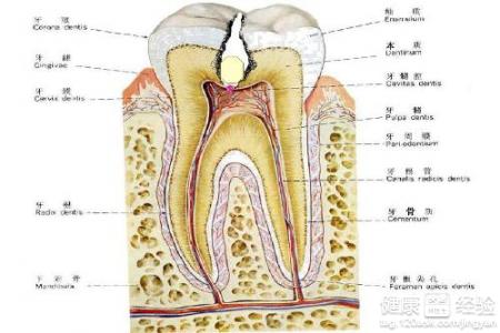 龋坏已经到侵蚀到牙神经的地步了该怎么办