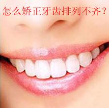 成人牙齿矫正牙齿要多少钱？