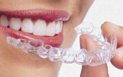 合肥做隐形牙套多少钱？