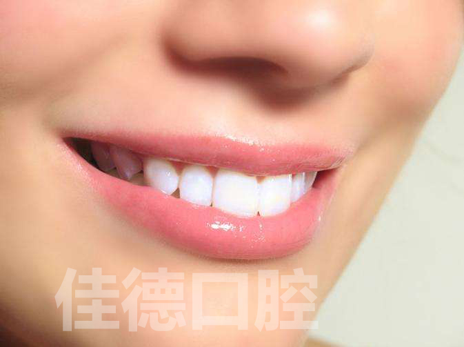 合肥牙齿矫正哪家好?