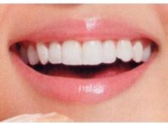 什么是倒牙牙齿敏感能治吗?