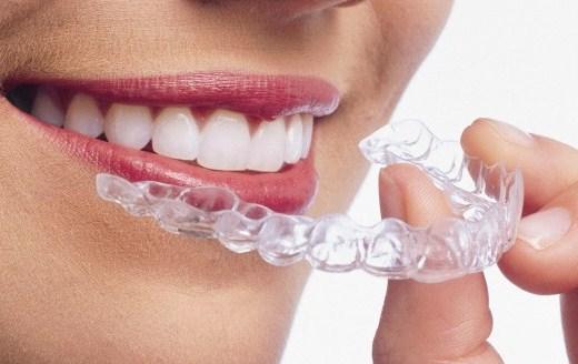 成人牙齿矫正需要要多久？