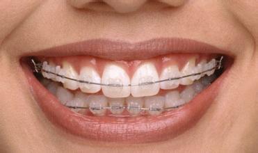 儿童畸形的牙越早矫正越好吗？