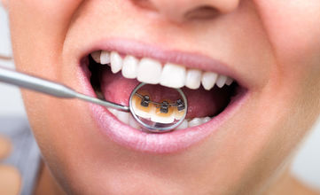 牙齿错位牙齿矫正什么时候可以做?