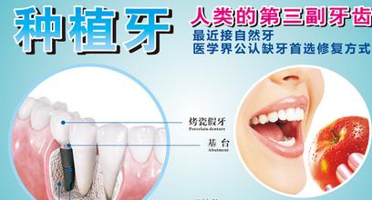 牙齿种植过程中会有不适吗？